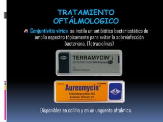 Conjuntivitis vírica se instila un antibiótico bacteriostático de
amplio espectro tópicamente para evitar la sobreinfección
bacteriana. (Tetraciclinas)
Disponibles en colirio y en un ungüento oftálmico.
TRATAMIENTO
OFTÁLMOLOGICO
 