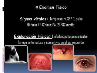 Examen Físico
Signos vitales: Temperatura 38° C; pulso
94/min; FR 12/min; PA 124/82 mmHg.
Exploración Física: Linfadenopatía preauricular,
faringe eritematosa y conjuntivis en el ojo izquierdo.
 
