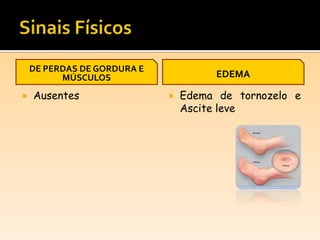 DE PERDAS DE GORDURA E
MÚSCULOS
 Ausentes
EDEMA
 Edema de tornozelo e
Ascite leve
 