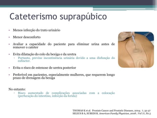 Cateterismo suprapúbico
• Menos infecção do trato urinário

• Menor desconforto

• Avaliar a capacidade do paciente para eliminar urina antes de
  remover o cateter

• Evita dilatação do colo da bexiga e da uretra
   ▫   Portanto, previne incontinência urinária devido a uma disfunção do
       esfíncter.

• Evita o risco de estenose de uretra posterior

• Preferível em pacientes, especialmente mulheres, que requerem longo
  prazo de drenagem da bexiga


No entanto:
   ▫   Risco aumentado de complicações associadas com a colocação
       (perfuração do intestino, infecção da ferida)



                                            THOMAS K et al. Prostate Cancer and Prostatic Diseases, 2004; 7, 32-37
                                            SELIUS B A, SUBEDI R. American Family Physician, 2008 ; Vol 77, No 5
 