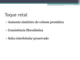 Toque retal
• Aumento simétrico do volume prostático

• Consistência fibroelástica

• Sulco interlobular preservado
 