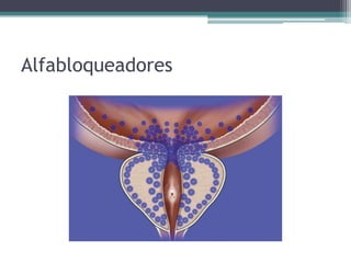 Alfabloqueadores
 