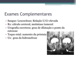 Exames Complementares
• Sangue: Leucocitose; Relação U/Cr elevada
• Rx: cálculo ureteral, metástase tumoral
• Urografia excretora: grau de dilatação e ponto da
  estenose
• Toque retal: aumento da próstata
• Us: grau da hidronefrose
 