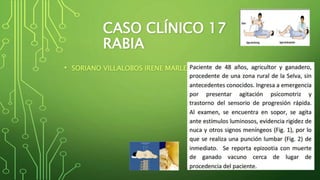 CASO CLÍNICO 17 
RABIA 
• SORIANO VILLALOBOS IRENE MARLENY 
 