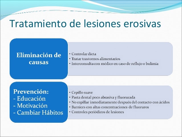 Operatoria dental barrancos