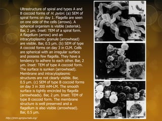 Ultrastructure of spiral and types A and
B coccoid forms of H. pylori. (a) SEM of
spiral forms on day 1. Flagella are seen
on one side of the cells (arrows). A
spherical organism is visible (asterisk).
Bar, 2 μm. Inset: TEM of a spiral form.
A flagellum (arrow) and an
intracytoplasmic granule (arrowhead)
are visible. Bar, 0.5 μm. (b) SEM of type
A coccoid forms on day 3 in CLM. Cells
are spherical with an irregular surface
and possess few flagella. They have a
tendency to adhere to each other. Bar, 2
μm. Inset: TEM of type A coccoid form.
The surface is sunken (arrowhead).
Membrane and intracytoplasmic
structures are not clearly visible. Bar,
0.5 μm. (c) SEM of type B coccoid forms
on day 3 in 300 mM-LM. The smooth
surface is tightly encircled by flagella
(arrowheads). Bar, 2 μm. Inset: TEM of
type B coccoid form. The membrane
structure is well preserved and a
flagellum is also visible (arrowhead).
Bar, 0.5 μm.
http://jmm.sgmjournals.org/

 