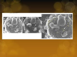 Caso clínico 1 - MEB