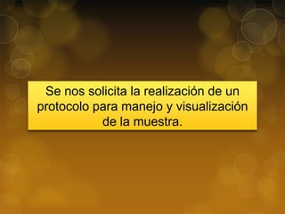 Se nos solicita la realización de un
protocolo para manejo y visualización
de la muestra.

 