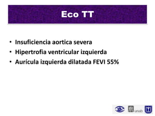 Eco TT


• Insuficiencia aortica severa
• Hipertrofia ventricular izquierda
• Aurícula izquierda dilatada FEVI 55%
 