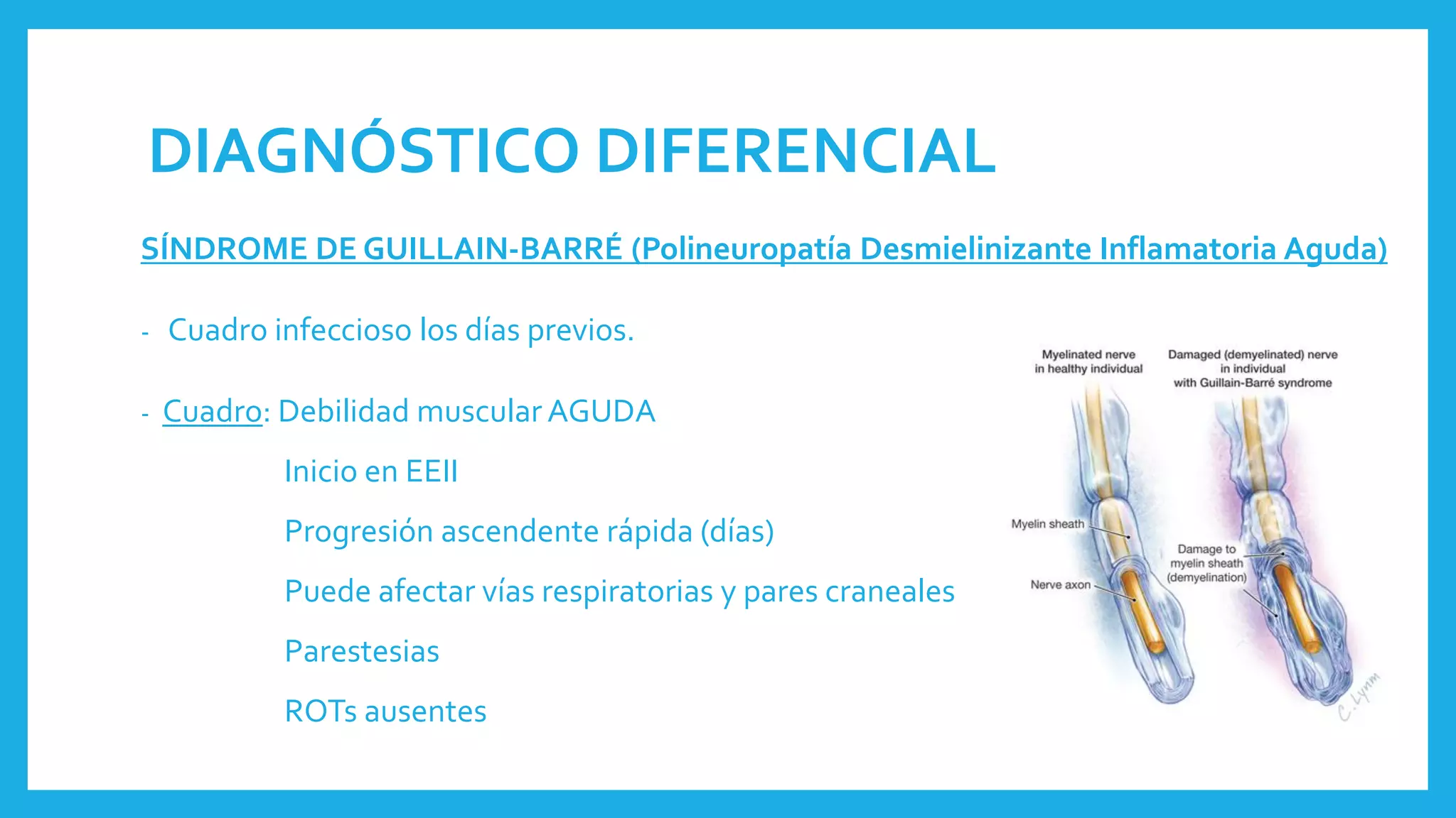 DIAGNÓSTICO DIFERENCIAL
SÍNDROME DE GUILLAIN-BARRÉ (Polineuropatía Desmielinizante Inflamatoria Aguda)
- Cuadro infeccioso los días previos.
- Cuadro: Debilidad muscular AGUDA
Inicio en EEII
Progresión ascendente rápida (días)
Puede afectar vías respiratorias y pares craneales
Parestesias
ROTs ausentes
 