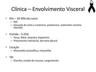 Clínica – Envolvimento Visceral
• Rim – 10-30% dos casos
   – NIA
   – Elevação de uréia e creatinina, proteinúria, sedimento urinário
     alterado

• Pulmão – 5-25%
   – Tosse, febre, dispnéia, hipoxemia
   – Pneumonite intersticial, derrame pleural

• Coração
   – Miocardite eosinofílica, miocardite

• TGI
   – Diarréia, erosão de mucosa, sangramento
 