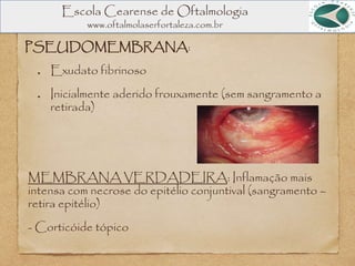 Escola Cearense de Oftalmologia
www.oftalmolaserfortaleza.com.br
PSEUDOMEMBRANA:
Exudato fibrinoso
Inicialmente aderido frouxamente (sem sangramento a
retirada)
MEMBRANA VERDADEIRA: Inflamação mais
intensa com necrose do epitélio conjuntival (sangramento –
retira epitélio)
- Corticóide tópico
 