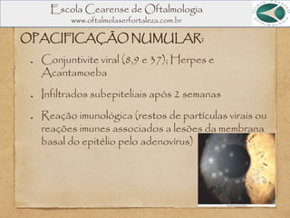 Escola Cearense de Oftalmologia
www.oftalmolaserfortaleza.com.br
OPACIFICAÇÃO NUMULAR:
Conjuntivite viral (8,9 e 37); Herpes e
Acantamoeba
Infiltrados subepiteliais após 2 semanas
Reação imunológica (restos de partículas virais ou
reações imunes associados a lesões da membrana
basal do epitélio pelo adenovírus)
 