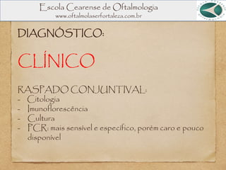 Escola Cearense de Oftalmologia
www.oftalmolaserfortaleza.com.br
DIAGNÓSTICO:
CLÍNICO
RASPADO CONJUNTIVAL:
- Citologia
- Imunoflorescência
- Cultura
- PCR: mais sensível e específico, porém caro e pouco
disponível
 