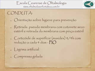 Escola Cearense de Oftalmologia
www.oftalmolaserfortaleza.com.br
CONDUTA:
Orientação sobre higiene para prevenção
Retirada pseudo membrana com cotonete seco
estéril e retirada da membrana com pinça estéril
Corticóide de superfície (maxidex) 4/4h com
redução a cada 4 dias - PIO
Lágrima artificial
Compressa gelada
 