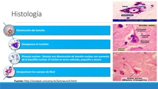 Histología
Disminución del tamaño
Desaparece el nucléolo
Picnosis nuclear: Denota una disminución de tamaño nuclear con aumento
de la basofilia nuclear. El núcleo se torna redondo, pequeño y oscuro
Desaparecen los cuerpos de Nissl
Fuente: http://anatpat.unicamp.br/lamneuro3.html
 