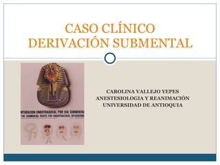 CAROLINA VALLEJO YEPES ANESTESIOLOGIA Y REANIMACIÓN UNIVERSIDAD DE ANTIOQUIA CASO CLÍNICO DERIVACIÓN SUBMENTAL 
