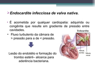 Endocardite infecciosa de valva nativa.
• É acometida por qualquer cardiopatia: adquirida ou
congênita que resulte em gradiente de pressão entre
cavidades.
• Fluxo turbulento da câmara de
> pressão para a de < pressão.
Lesão do endotélio e formação do
trombo estéril– alicerce para
aderência bacteriana.
 