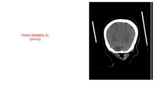 THEM CEREBRAL SC
23-02-23
 