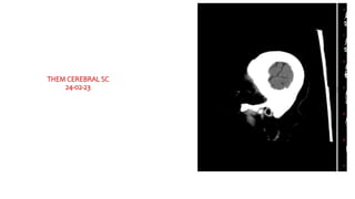 THEM CEREBRAL SC
24-02-23
 