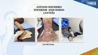 ANEXOS MIEMBRO
INFERIOR IZQUIERDO
(ANTES)
30/08/2023
20
 