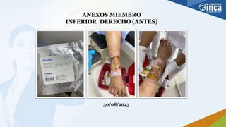 ANEXOS MIEMBRO
INFERIOR DERECHO (ANTES)
30/08/2023
21
 