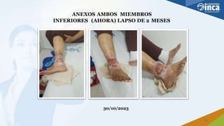 ANEXOS AMBOS MIEMBROS
INFERIORES (AHORA) LAPSO DE 2 MESES
30/10/2023
22
 