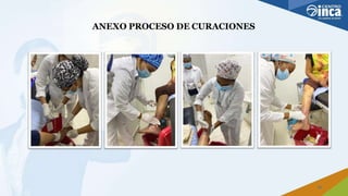 ANEXO PROCESO DE CURACIONES
23
 