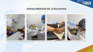 ANEXO PROCESO DE CURACIONES
24
 