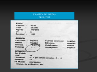 EXAMEN DE ORINA
   24/08/2011
 