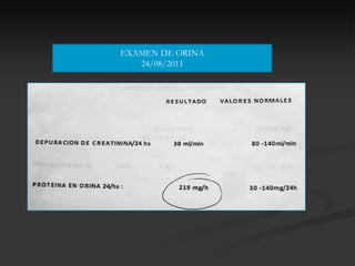 EXAMEN DE ORINA
   24/08/2011
 