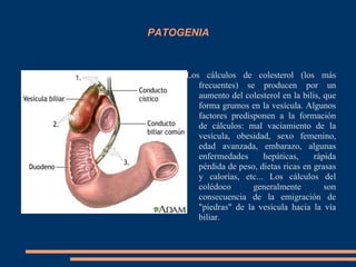 PATOGENIA
Los cálculos de colesterol (los más
frecuentes) se producen por un
aumento del colesterol en la bilis, que
forma grumos en la vesícula. Algunos
factores predisponen a la formación
de cálculos: mal vaciamiento de la
vesícula, obesidad, sexo femenino,
edad avanzada, embarazo, algunas
enfermedades hepáticas, rápida
pérdida de peso, dietas ricas en grasas
y calorías, etc... Los cálculos del
colédoco generalmente son
consecuencia de la emigración de
"piedras" de la vesícula hacia la vía
biliar.
 