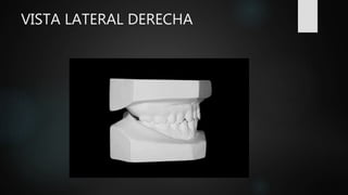 Caso clínico ortodoncia daniel pinos gavilanes