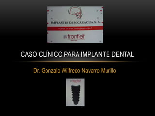 CASO CLÍNICO PARA IMPLANTE DENTAL
Dr. Gonzalo Wilfredo Navarro Murillo

 