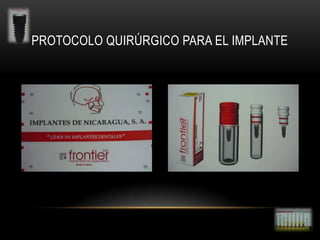 PROTOCOLO QUIRÚRGICO PARA EL IMPLANTE

 