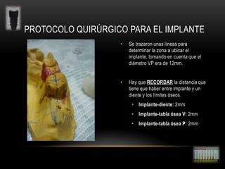 PROTOCOLO QUIRÚRGICO PARA EL IMPLANTE
•

Se trazaron unas líneas para
determinar la zona a ubicar el
implante, tomando en cuenta que el
diámetro VP era de 12mm.

•

Hay que RECORDAR la distancia que
tiene que haber entre implante y un
diente y los límites óseos.
• Implante-diente: 2mm
• Implante-tabla ósea V: 2mm
• Implante-tabla ósea P: 2mm

 