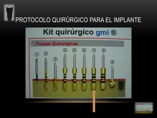PROTOCOLO QUIRÚRGICO PARA EL IMPLANTE

 