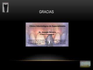 GRACIAS

 