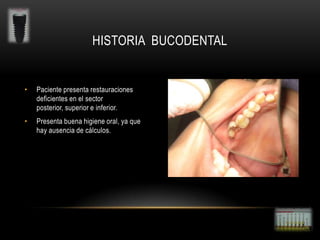 HISTORIA BUCODENTAL

•

Paciente presenta restauraciones
deficientes en el sector
posterior, superior e inferior.

•

Presenta buena higiene oral, ya que
hay ausencia de cálculos.

 