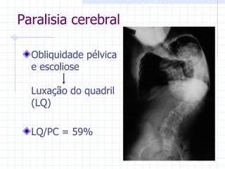 Obliquidade pélvica e escoliose Luxação do quadril (LQ) LQ/PC = 59% Paralisia cerebral 