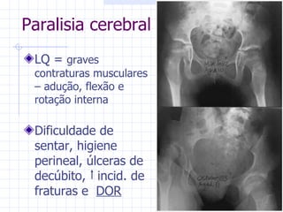 LQ =  graves contraturas musculares – adução, flexão e rotação interna Dificuldade de sentar, higiene perineal, úlceras de decúbito,  incid. de fraturas e  DOR Paralisia cerebral 