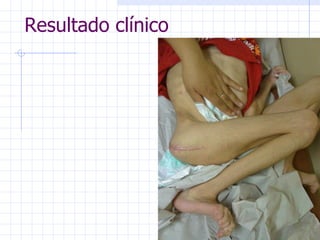 Resultado clínico 