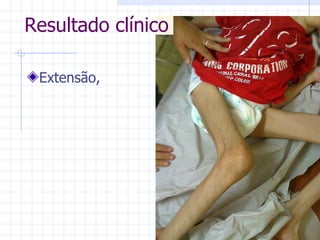 Extensão, Resultado clínico 