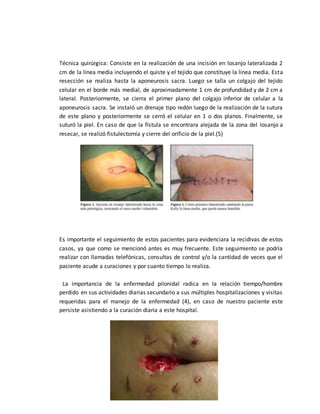 Caso clínico; quiste pilonidal | DOCX