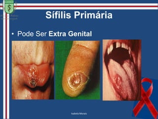 Colombiana:Ruy Dias – Da Enfermidade Serpentina de Isla.Restos Ósseos.Pré-Colombiana:                             (1) Chineses, Gregos e Bíblicos; Restos ósseos.África: Origem.Migrações / Mutações. 1ª carateum ; 2ª pertenue  Caráter Sexual                                             (2)Gleydson Abreu             