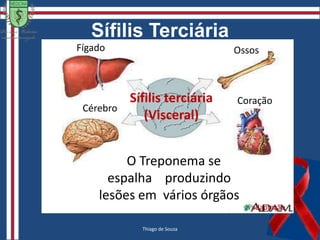 SífilisTreponema pallidumsubsppallidum- Move-se por rotação do corpo em volta dos filamentos.- Não é cultivável. É patógeno exclusivo do ser humano.- É destruído pelo calor e pela falta de umidade, não resistindo muito tempo fora do seu ambiente (26 horas).-  Divide-se transversalmente a cada 30 horas.Camila Maria