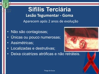SífilisTransmissãoVia Sexual (SífilisAdquirida) e Verticalmente (SífilisCongênita).O risco de contágiovaria de 10% a 60%.	95% se dápelocontato genital com lesõesinfectantes.Indireta (objetoscontaminados, tatuagem) e TransfusãoSanguínea.Camila Maria