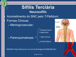  Sífilis LatenteTardia:Sífilis Terciária (Tegumentar, Cardiovascular, Neurossífilis, Meningovascular).Isabela Morais