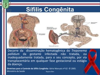 Erupção generalizada, simétrica, aspecto variável;