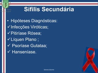 Sífilis SecundáriaAíla Pinheirohttp://dermatlas.med, 